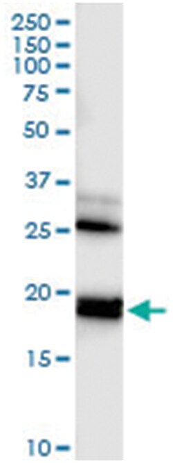 anti-RHEB, Human, IP-WB Antibody Pair, Abnova 1 Set:Antibodies