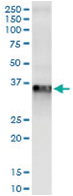 anti-RLBP1, Human, IP-WB Antibody Pair, Abnova™