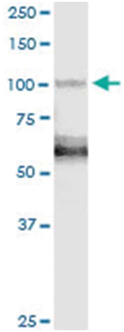 anti-BRD2, Human, IP-WB Antibody Pair, Abnova 1 Set | Buy Online | Abnova Corporation | Fisher Scientific