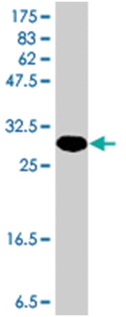 RNF4, Mouse, Polyclonal Antibody, Abnova 50&mu;L; Unlabeled:Antibodies,