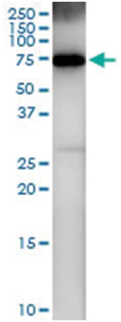 anti-RNF6, Human, IP-WB Antibody Pair, Abnova™