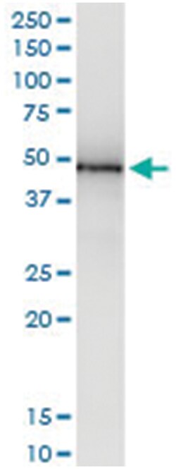 anti-RNH1, Human, IP-WB Antibody Pair, Abnova™