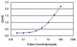 anti-RP2, Human, Matched Antibody Pair, Abnova 1 Set:Antibodies, Monoclonal/Polyclonal