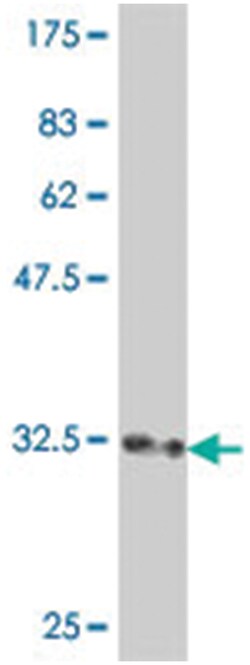 RPL3L, Mouse, Polyclonal Antibody, Abnova 50&mu;L; Unlabeled:Antibodies,