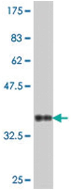 RPL15, Mouse, Polyclonal Antibody, Abnova 50&mu;L; Unlabeled:Antibodies,