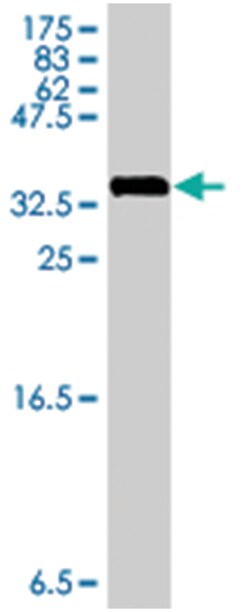 RPL29, Mouse, Polyclonal Antibody, Abnova 50&mu;L; Unlabeled:Antibodies,
