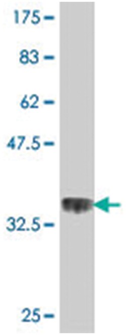 RPL35A, Mouse, Polyclonal Antibody, Abnova 50&mu;L; Unlabeled:Antibodies,