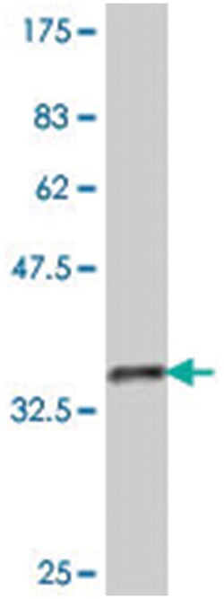 RPL39, Mouse, Polyclonal Antibody, Abnova 50&mu;L; Unlabeled:Antibodies,