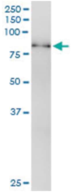 anti-RPS6KB1, Human, IP-WB Antibody Pair, Abnova&trade;