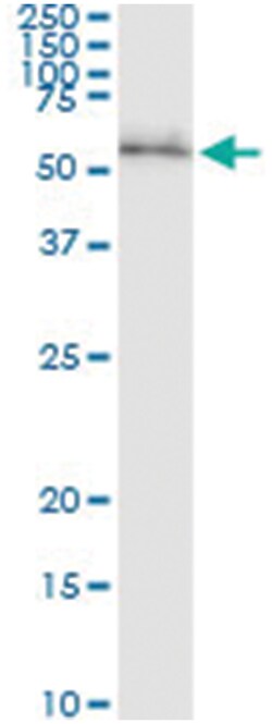 anti-RPS6KB2, Human, IP-WB Antibody Pair, Abnova&trade;