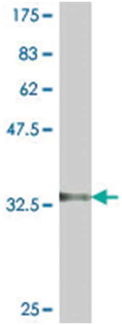RPS11, Mouse, Polyclonal Antibody, Abnova 50&mu;L; Unlabeled:Antibodies,