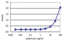 anti-RPS14, Human, Matched Antibody Pair, Abnova™