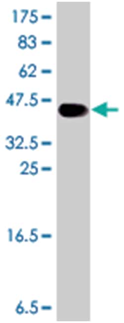 RRM2 (A01), Mouse anti-Human, Polyclonal Antibody, Abnova 50&mu;L; Unlabeled:Antibodies,