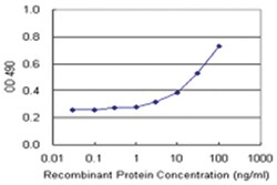 anti-RRM2 Matched Antibody Pair, Abnova