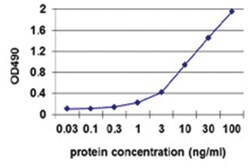 anti-RRM2, Human, Matched Antibody Pair, Abnova™