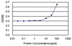 anti-RTN2 Matched Antibody Pair, Abnova 1 Set, Unlabeled:Antibodies, Monoclonal/Polyclonal