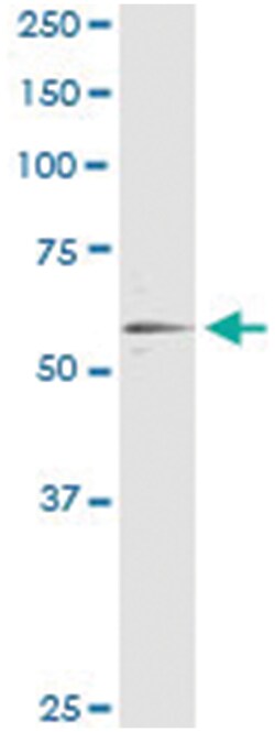 RXRA, Human, IP-WB Antibody Pair (PW1), Abnova&trade;