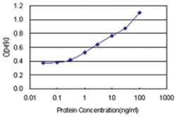 S100A7, Human, Matched Antibody Pair (AP23), Abnova&trade;