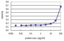 S100A7, Human, Matched Antibody Pair (AP41), Abnova 1 Set:Antibodies, Monoclonal/Polyclonal