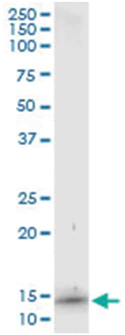 S100A7, Human, IP-WB Antibody Pair (PW2), Abnova&trade;