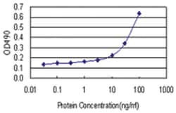 anti-S100A8 Matched Antibody Pair, Ab-2, Abnova 1 Set:Antibodies