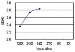 S100A8, Human, Matched Antibody Pair (AP52), Abnova 1 set, Unlabeled:Antibodies