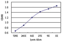 S100A8, Human, Matched Antibody Pair (AP61), Abnova 1 set, Unlabeled:Antibodies