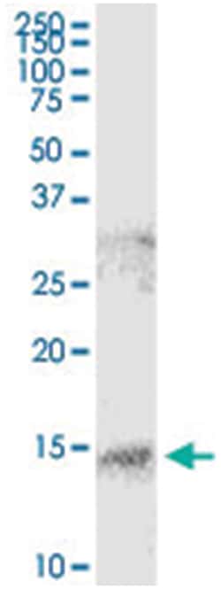 anti-S100A9, Human, IP-WB Antibody Pair, Abnova 1 Set:Antibodies
