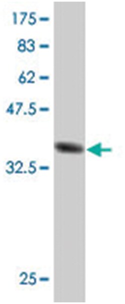 S100A10, Mouse, Polyclonal Antibody, Abnova 50 &mu;L | Buy Online | Abnova | Fisher Scientific