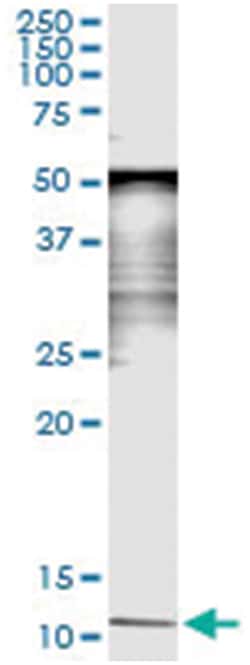SAA4, Human, IP-WB Antibody Pair (PW2), Abnova 1 Set:Antibodies, Monoclonal/Polyclonal