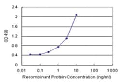 anti-SALL2 Matched Antibody Pair, Abnova