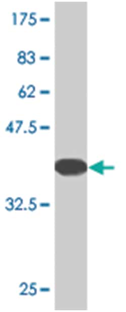 ATXN1, Mouse, Clone: 4C5, Abnova 100 &mu;g | Buy Online | Abnova Corporation | Fisher Scientific