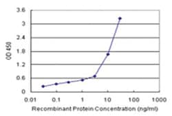 anti-SERPINB3 Matched Antibody Pair, Abnova