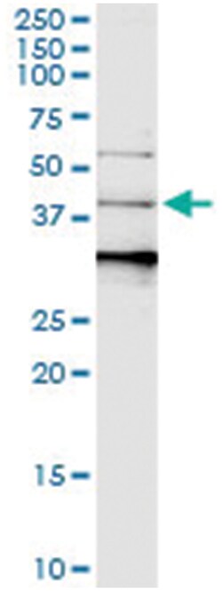 SERPINB3, Human, IP-WB Antibody Pair (PW5), Abnova 1 Set:Antibodies, Monoclonal/Polyclonal