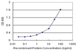 anti-SCML1 Matched Antibody Pair, Abnova