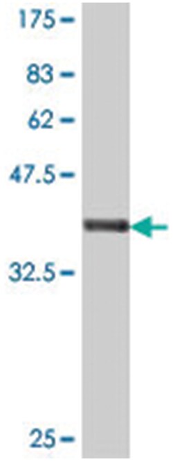 SCO1, Mouse, Polyclonal Antibody, Abnova 50 &mu;L | Buy Online | Abnova | Fisher Scientific