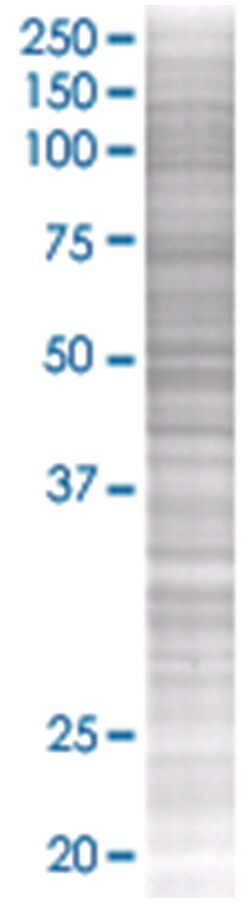 SCTR 293T Cell Overexpression Lysate (Denatured), Abnova 100 &mu;l | Buy Online | Abnova | Fisher Scientific