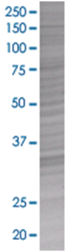 CCL11 293T Cell Overexpression Lysate (Denatured), Abnova 100 &mu;L | Buy Online | Abnova | Fisher Scientific