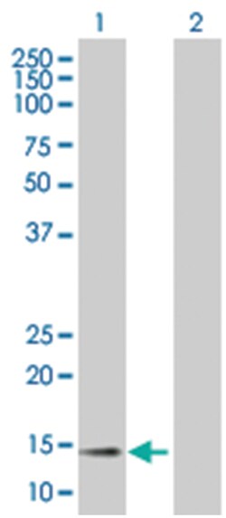 CCL11 293T Cell Overexpression Lysate (Denatured), Abnova 100 &mu;L | Buy Online | Abnova | Fisher Scientific