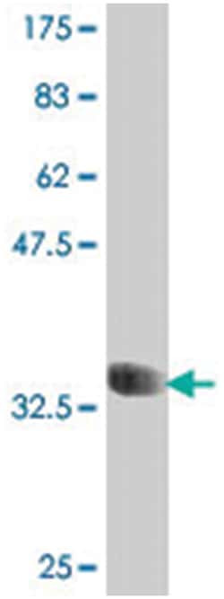 CCL15, Mouse, Polyclonal Antibody, Abnova 50&mu;L; Unlabeled:Antibodies,