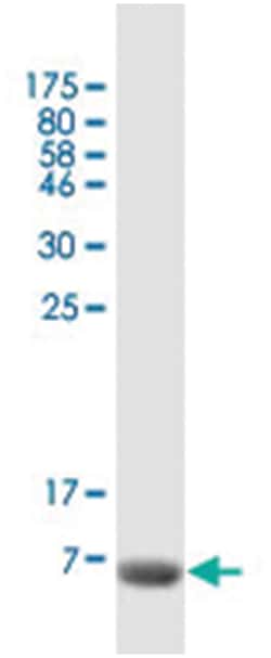 CCL17, Mouse, Clone: 2E7, Abnova 200&mu;L; Unlabeled:Antibodies, Monoclonal