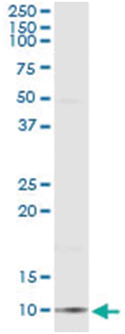 CCL18, Human, IP-WB Antibody Pair (PW2), Abnova 1 Set:Antibodies, Monoclonal/Polyclonal