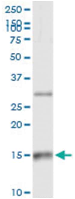 anti-CCL21, Human, IP-WB Antibody Pair, Abnova™