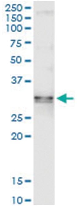 anti-SDCBP, Human, IP-WB Antibody Pair, Abnova 1 Set:Antibodies, Monoclonal/Polyclonal