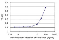 anti-SELE Matched Antibody Pair, Abnova