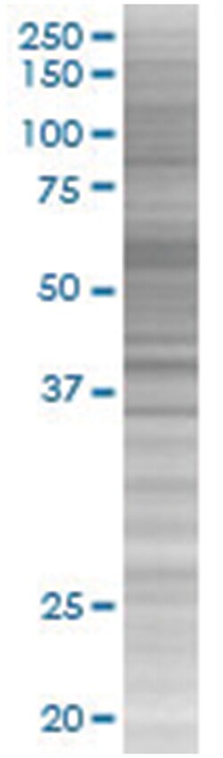 SELP 293T Cell Overexpression Lysate (Denatured), Abnova 100 &mu;L | Buy Online | Abnova | Fisher Scientific