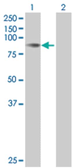 SELP 293T Cell Overexpression Lysate (Denatured), Abnova 100 &mu;L | Buy Online | Abnova | Fisher Scientific