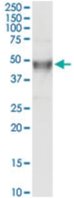 anti-MAP2K4, Human, IP-WB Antibody Pair, Abnova&trade;