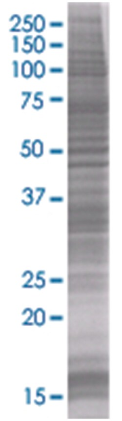 SFRS1 293T Cell Overexpression Lysate (Denatured), Abnova 100 &mu;L | Buy Online | Abnova | Fisher Scientific
