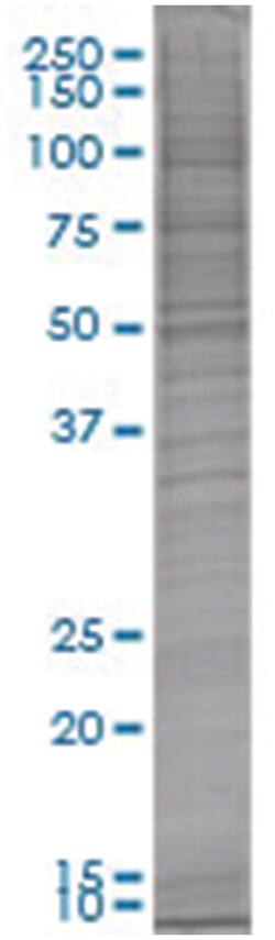 SFRS2 293T Cell Overexpression Lysate (Denatured), Abnova 100 &mu;L | Buy Online | Abnova | Fisher Scientific